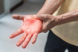 How Do You Prove Diabetic Neuropathy Qualifies You For Disability Insurance Benefits?