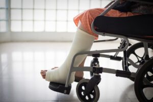 How to Win Your Social Security Disability Benefits for Fractured Leg using SSA Listing 1.06