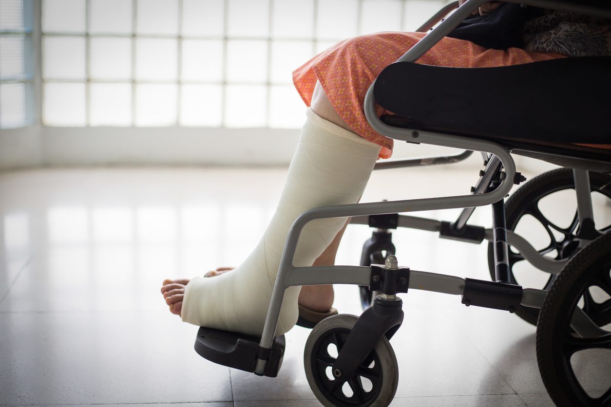 How to Win Your Social Security Disability Benefits for Fractured Leg using SSA Listing 1.06