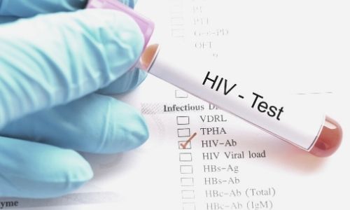 What Medical Evidence Is Needed To Qualify for SSDI for HIV/AIDs