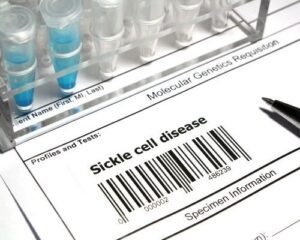 What Medical Evidence Is Needed to Prove a Sickle Cell Social Security Disability Claim?