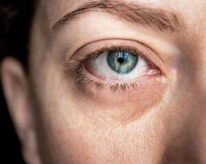 Eye Conditions and Social Security Disability Benefits