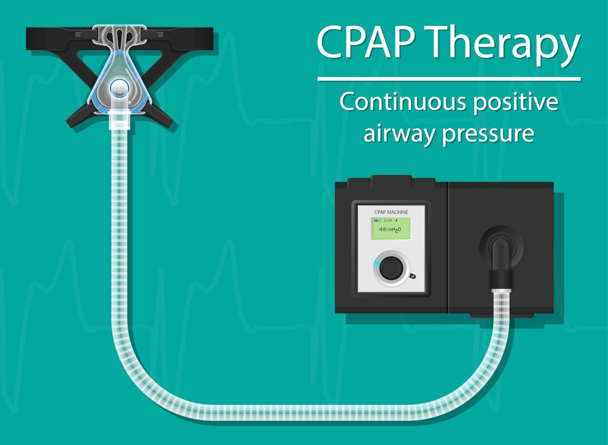 VA Sleep Apnea Ratings Are Changing Soon. Veterans: File Now!