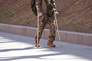 A veteran with plantar fasciitis is walking with crutches. The VA rating for his plantar fasciitis depends on the severity of his condition. VA Claims Process: Requirements for Obtaining Service-Connected Disability Compensation